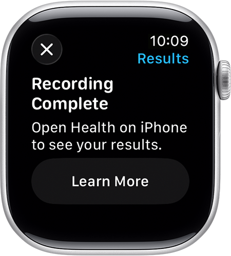 An Apple Watch screen displaying a successful Blood Oxygen measurement with a checkmark and the percentage.